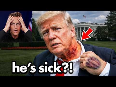 Internet in SHOCK at ‘Bloody’ Trump Neck…